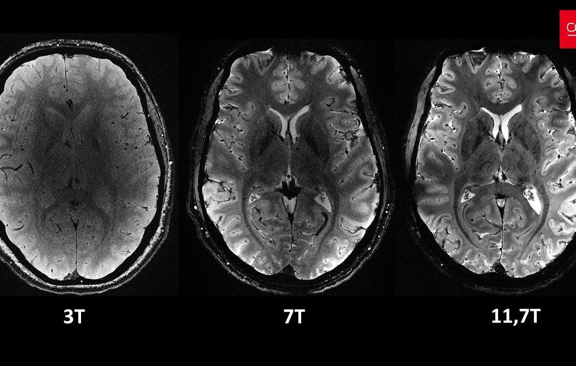 6a5b4000b6057.jpg Effet Stroop : le test qui piège votre cerveau