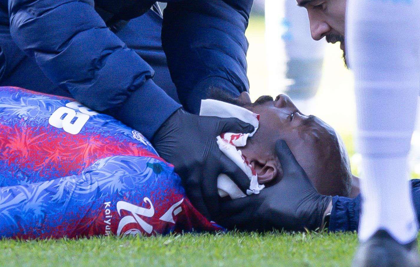 Mateta rassure après son violent choc en Coupe d’Angleterre