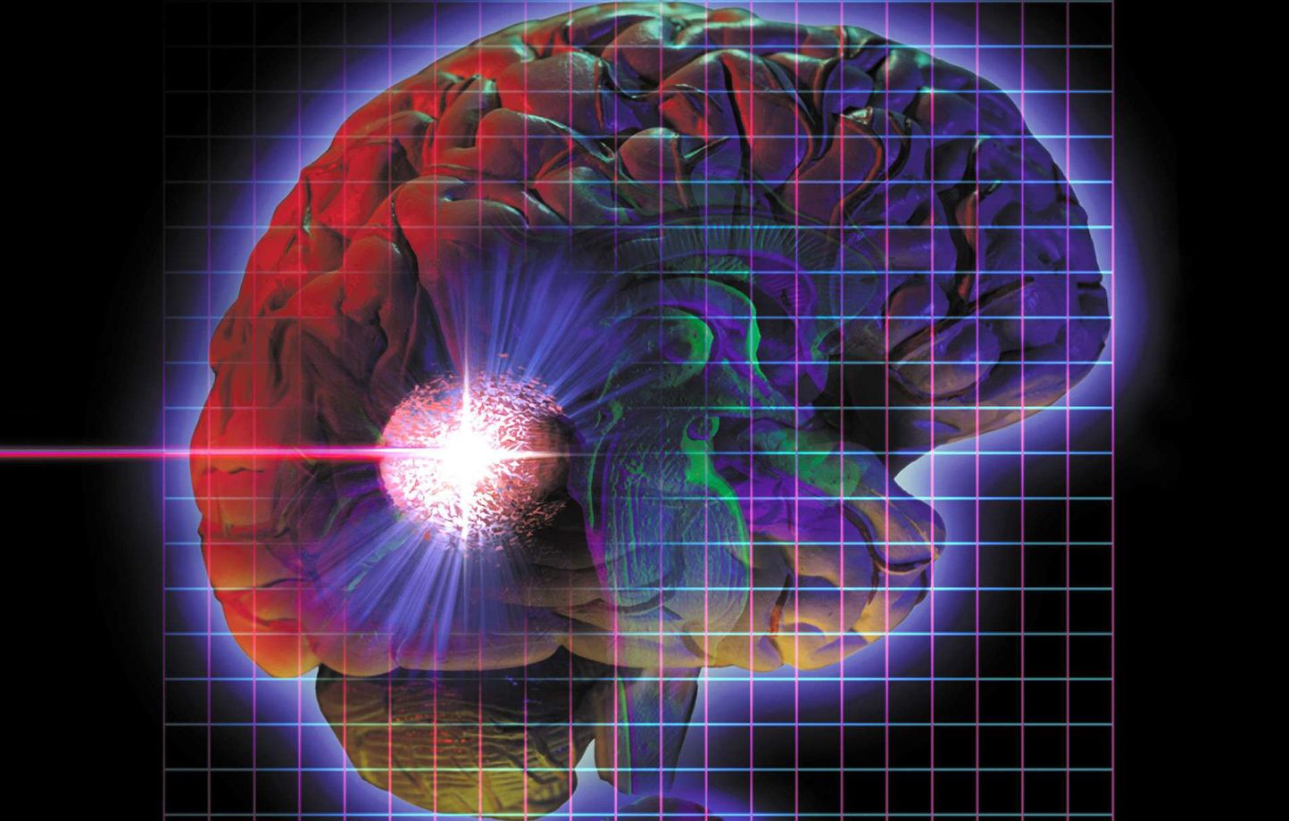 Le surmenage au travail menace la santé de votre cerveau