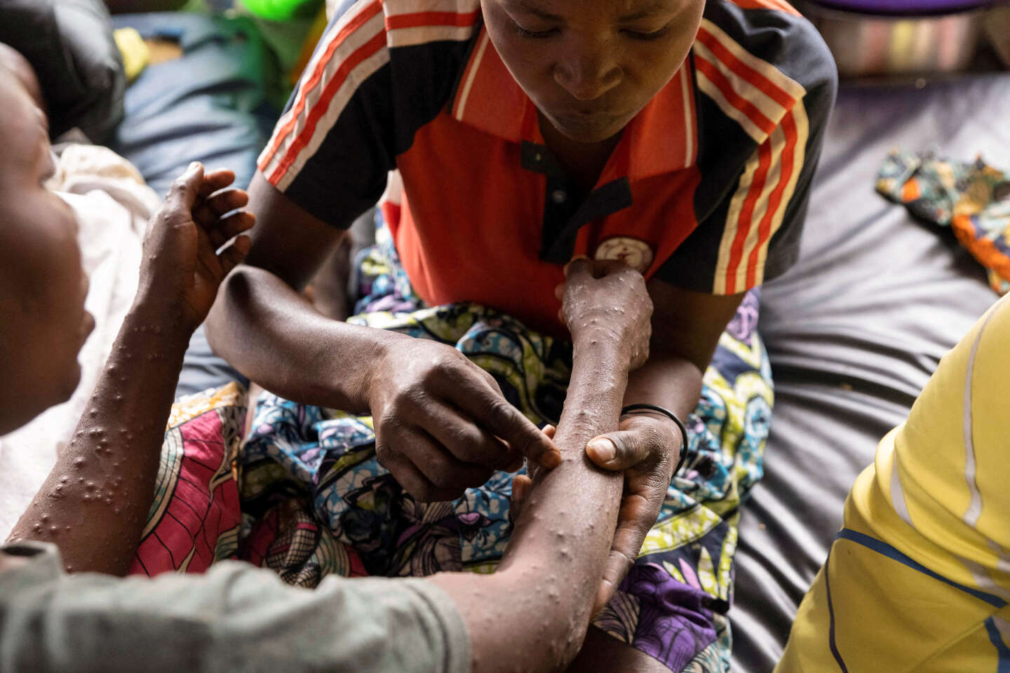 Mpox : une première livraison de vaccins est attendue jeudi 5 septembre en RDC