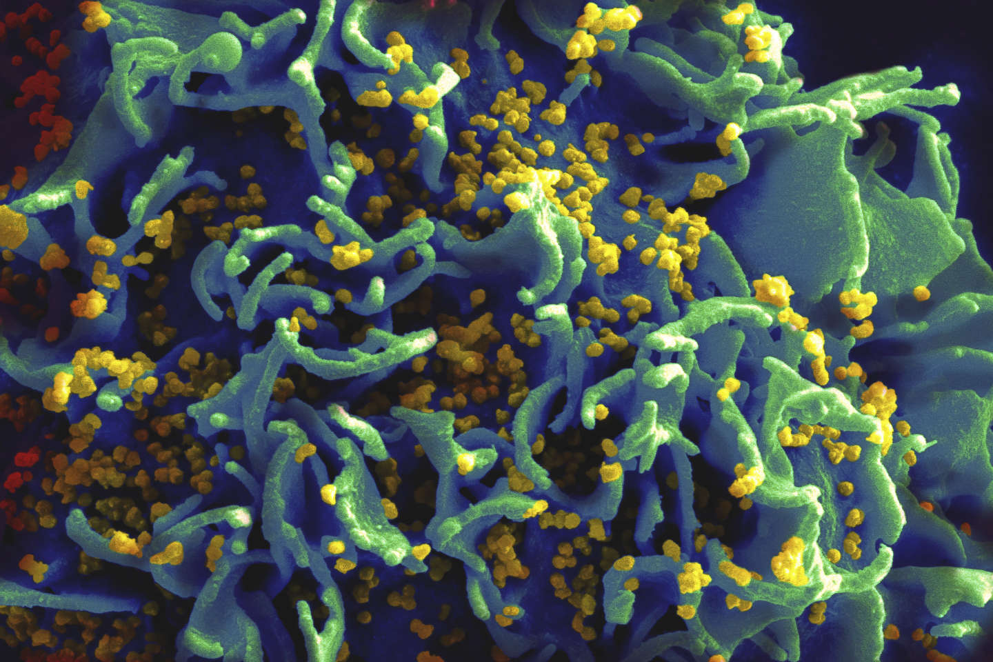 VIH : une équipe française teste un candidat-vaccin original